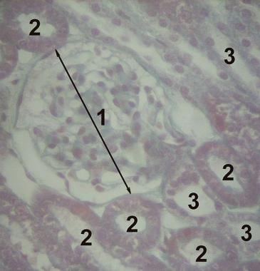Histologic image of a normal renal cortex, includi