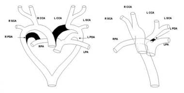 Left: Schematic diagram depicting the segments of 
