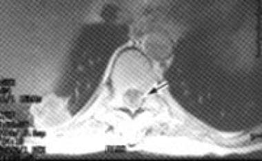 Axial, contrast-enhanced, T1-weighted magnetic res