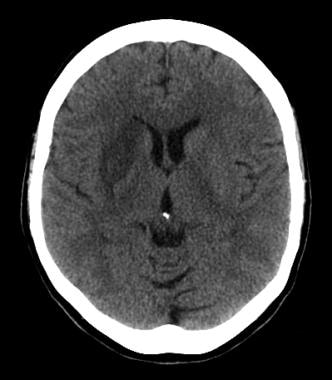 The test database of MR brain images and corresponding results for the