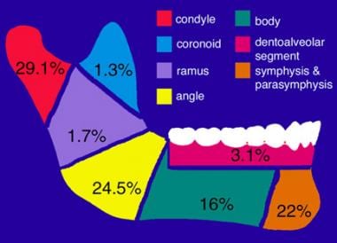 Sectional anatomy of the mandible with frequency o