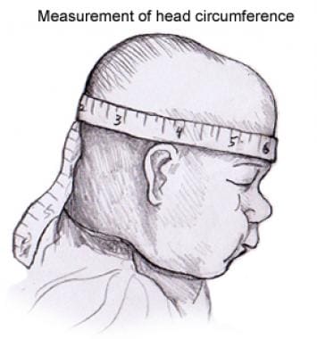 Measurement of head circumference. 