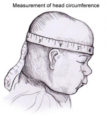 How to Measure Head Growth