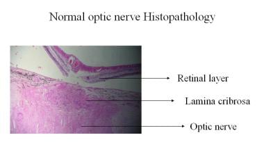 Normal optic nerve histopathology. 
