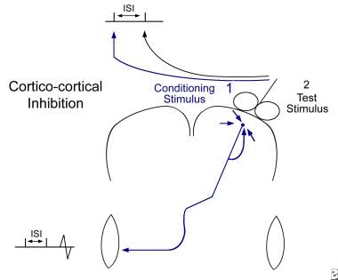 Systems tested for this study, clockwise from top left, iPulse