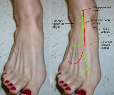 Foot with surface landmarks. Note the course of th