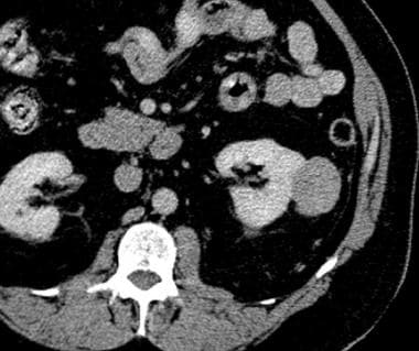 Contrast-enhanced computed tomography (CT) scan of