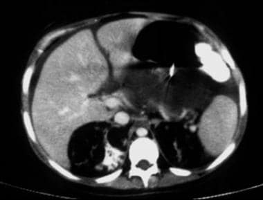 Image in a 16-year-old adolescent with bilateral r