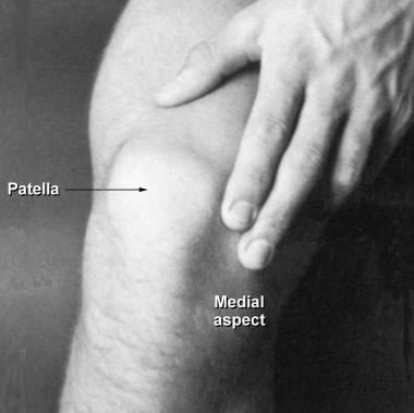 男性患者髌骨，内侧。