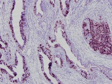 embryonal carcinoma cells