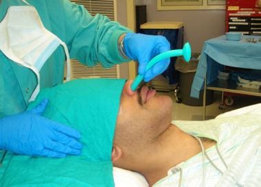 Inserting nasal trumpet. Note that insertion angle