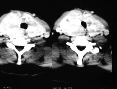These axial CT scans were obtained from a patient 