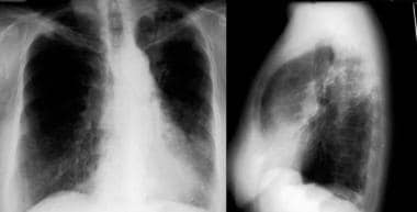 Images in a 60-year-old woman with a chronic cough