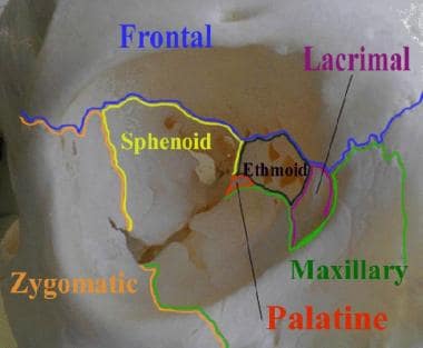 This image of the right orbit shows the 7 bones th