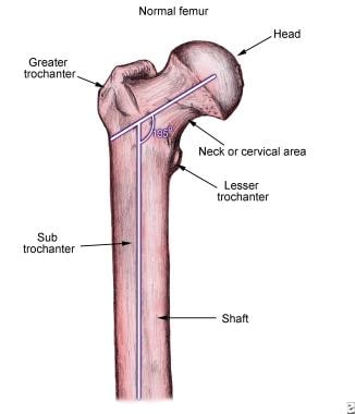 Normal femur anatomy. 