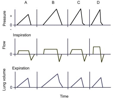 Wave forms of a volume-targeted ventilator: Pressu