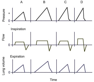 Tidal volume per kg body weight and mean inspiratory airflow