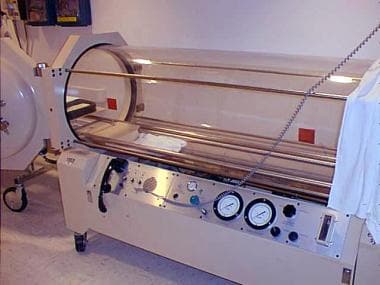 Monoplace hyperbaric chamber. Courtesy JG Benitez,