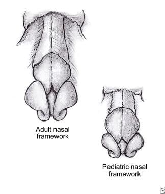 Nasal bone anatomy. 