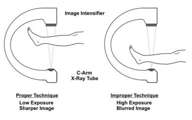 Which c-arm image intensifier you need widely depends on which type of studies you'll be performing.