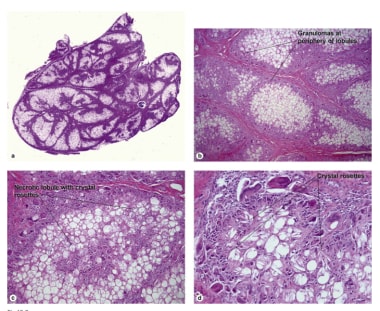 Histological slides of early and later stages of s