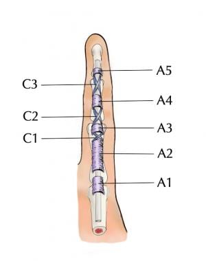 Location of anular and cruciform pulleys.