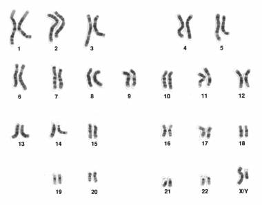 Human male karyotype. Courtesy of Wikimedia Common