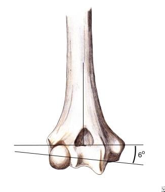 Supracondylar humerus fractures: anatomy. Trochlea