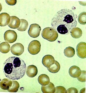 Neutrophils in this blood smear (original magnific