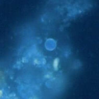 Oocyst of C cayetanensis viewed under UV microscop