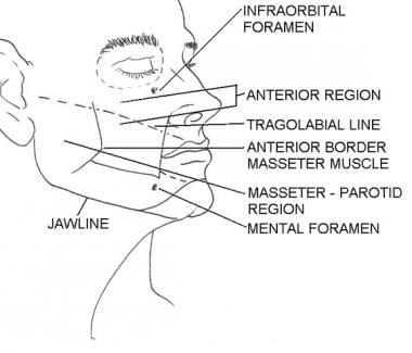 Subunits of the anterior region. Illustrated by Ch