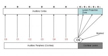 Masking. In this graphic, masking sounds are appli