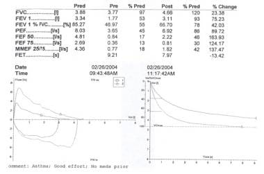 Asthma in Older Adults Workup: Pulmonary Function Tests, Imaging ...