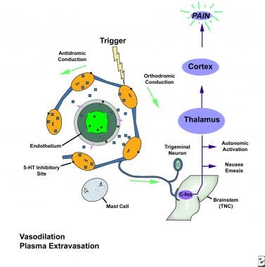 Trigeminovascular系统。三叉神经颤动