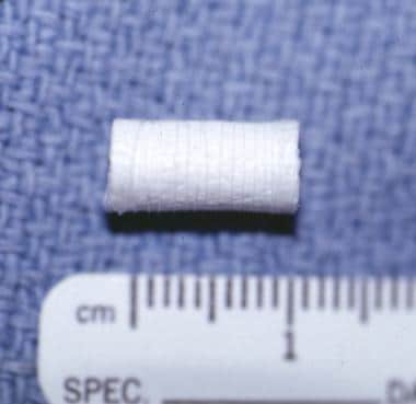 Solid spiral dissolvable stent produced for the tr