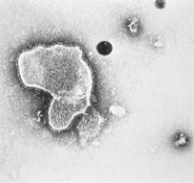 Electron micrograph of respiratory syncytial virus
