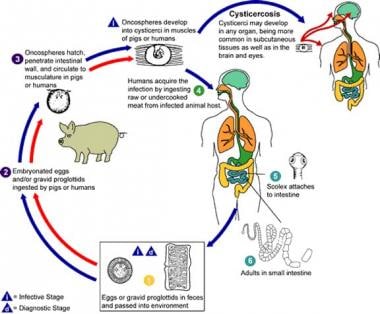Cysticercosis life cycle. Image courtesy of the Ce