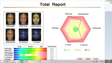  Facial Analysis Summary using Emage System.