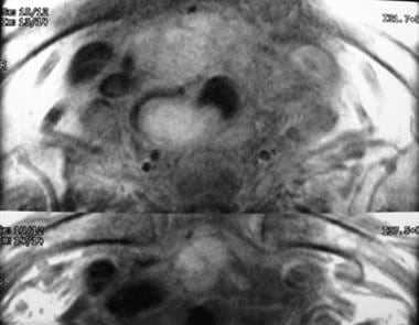 This axial magnetic resonance image was obtained f
