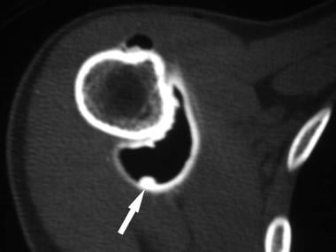 Double-contrast axial computed tomography (CT) art