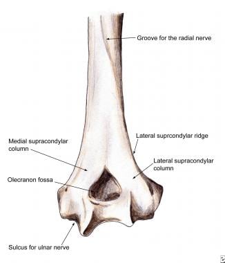 Supracondylar Humerus骨折：解剖学。注意Med.