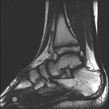 Nuclear magnetic resonance of the foot. This exami