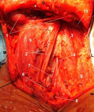 Patient in supine position and head turned to the 