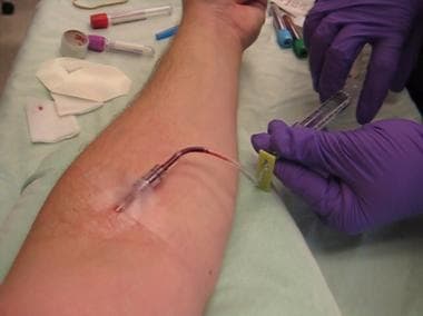 Flushing and locking venous access device for IV c