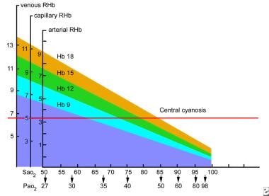 Cyanosis. Oxygen and hemoglobin values at which ce