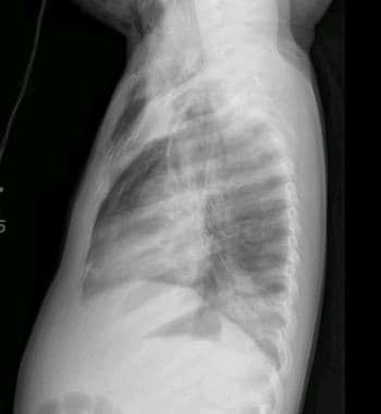 On the lateral radiograph from the patient in Medi