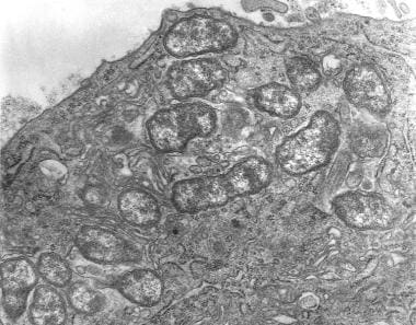 Transmission electron micrograph depicts peritonea