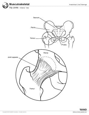 Early Signs of Hip Trouble: Peninsula Orthopedic Associates