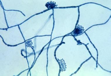 Tinea Nigra: Background, Pathophysiology, Etiology