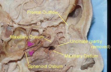 Cadaveric anatomy of the lateral nasal wall. 
